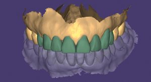 MOCK UP - tratamiento Caso CA