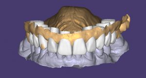 MOCK UP - tratamiento Caso JRA