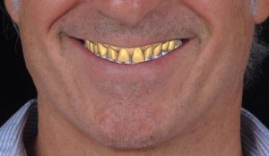 CASO ESTÉTICA JRA PREVIO