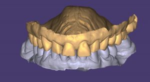 MOCK UP previo - tratamiento Caso JRA